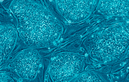 תאי גזע: פריצת דרך לטיפול באנטי אייג'ינג בשנת 2023?